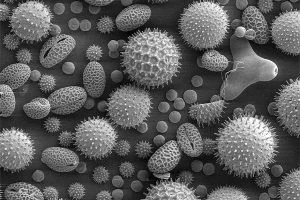 На территории Калининградской области случаев заболевания вирусом Эбола нет На территории Калининградской области случаев заболевания вирусом Эбола нет